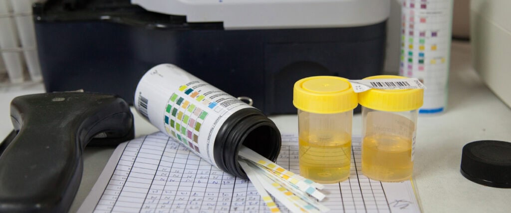 prescription drug testing using urine samples