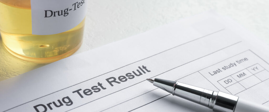 urine drug test results